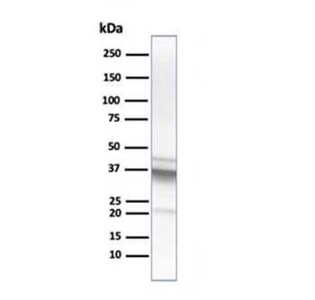 Arginase 1 Antibody