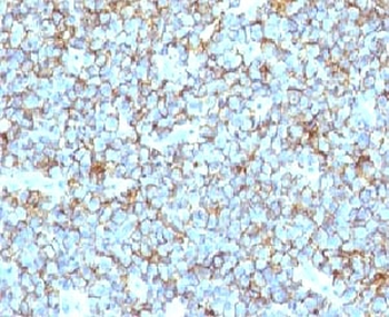 CD99 Antibody