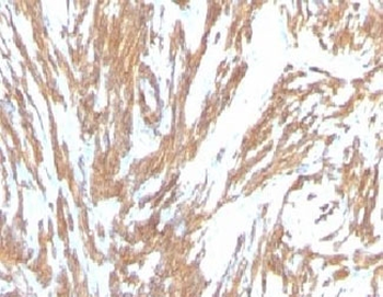 Alpha Smooth Muscle Actin Antibody
