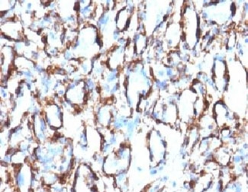 Alpha Smooth Muscle Actin Antibody