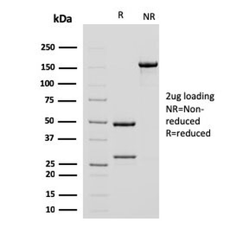 Alpha Smooth Muscle Actin Antibody