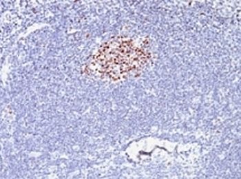 Bcl6 Antibody