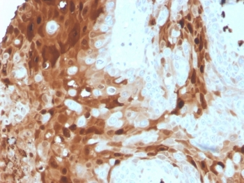 S100A9 Antibody