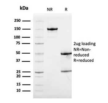 S100A9 Antibody