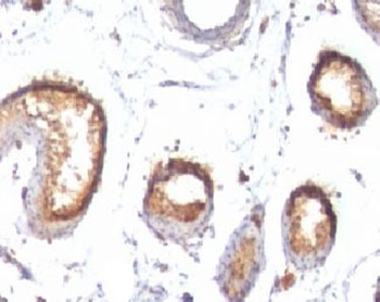 PMEL17 Antibody / Melanoma gp100