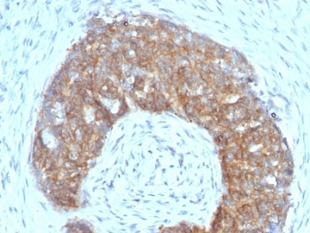 Estrogen Inducible Protein pS2 / TFF1 Antibody