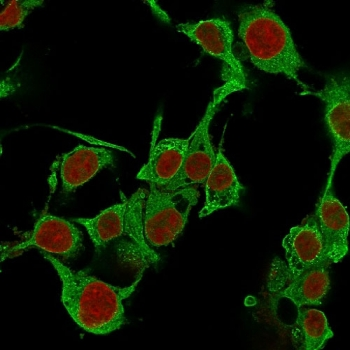 TNF alpha Antibody