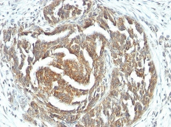 VEGF Antibody / VEGFA