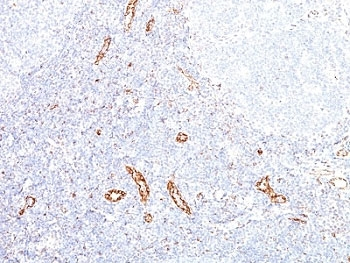VEGF Antibody / VEGFA