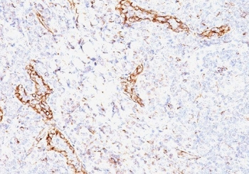 VEGF Antibody / VEGFA