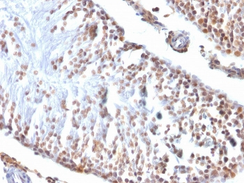WT1 Antibody / Wilms Tumor 1