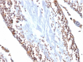 WT1 Antibody / Wilms Tumor 1