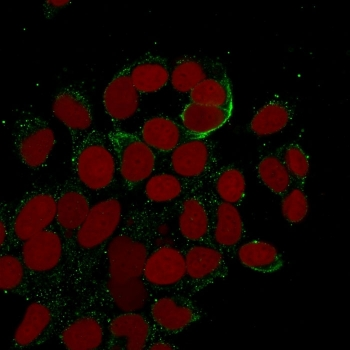 Cytokeratin 10/13 Antibody