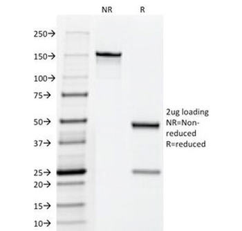 hCG Holo Antibody