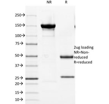 Cytokeratin 8/18 Antibody Cocktail