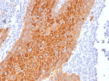 Pan Cytokeratin Antibody Cocktail