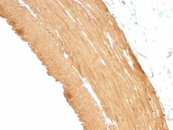 Pan Muscle Actin Antibody