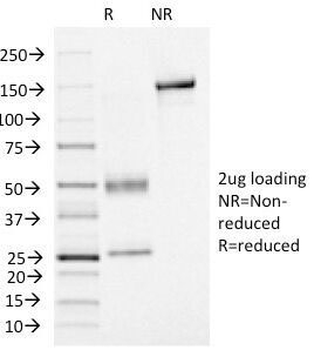 FOXA1 Antibody
