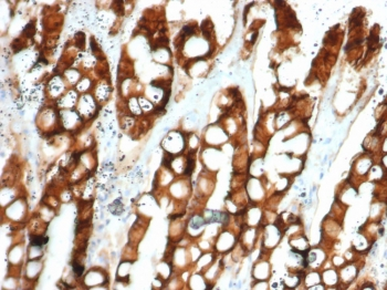 EpCAM Antibody / Extracellular domain