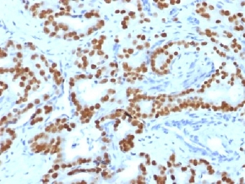 FOXA1 Antibody