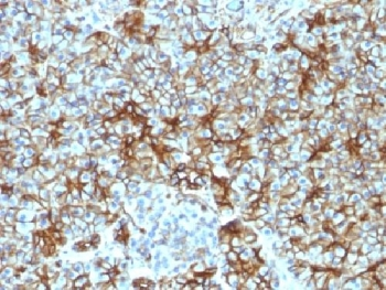 SPTBN2 Antibody / Spectrin beta III