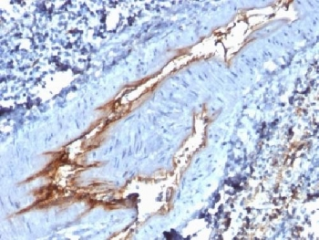von Willebrand Factor Antibody / vWF