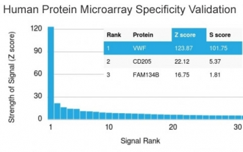 von Willebrand Factor Antibody / vWF
