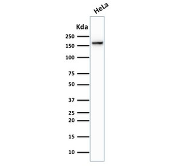 Topoisomerase II alpha Antibody / TOP2A