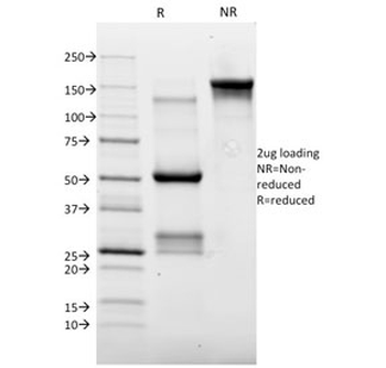 Topoisomerase II alpha Antibody / TOP2A