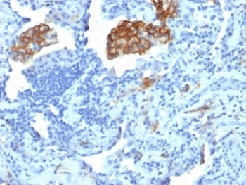 DC-SIGN Antibody / CD209