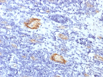 von Willebrand Factor Antibody / vWF