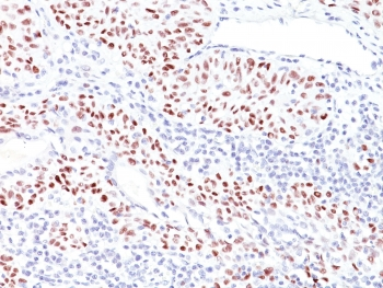 p53 Antibody / TP53