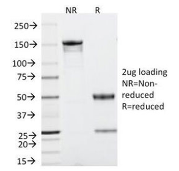 p53 Antibody / TP53