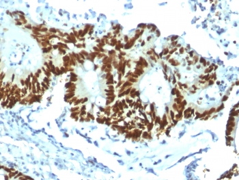p53 Antibody / TP53