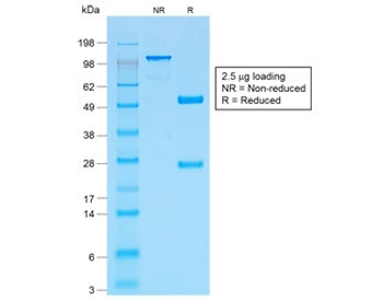p53 Antibody / TP53
