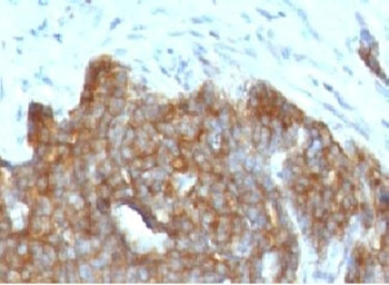 Estrogen Inducible Protein pS2 / TFF1 Antibody