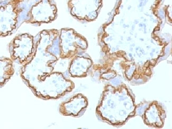 E-Cadherin Antibody / CDH1