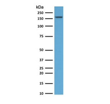 Topoisomerase II alpha Antibody / TOP2A