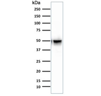 GFAP Antibody / Glial Fibrillary Acidic Protein