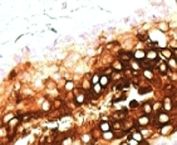 Cytokeratin 17 Antibody