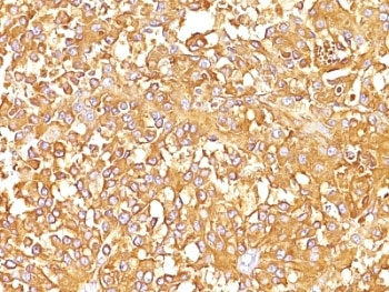 PMEL17 / Melanoma gp100 Antibody