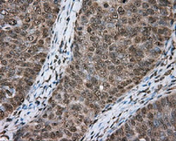 ACSBG1 Antibody
