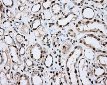 ACSBG1 Antibody