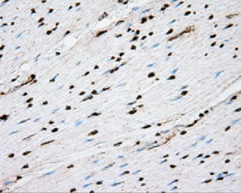 ACSBG1 Antibody
