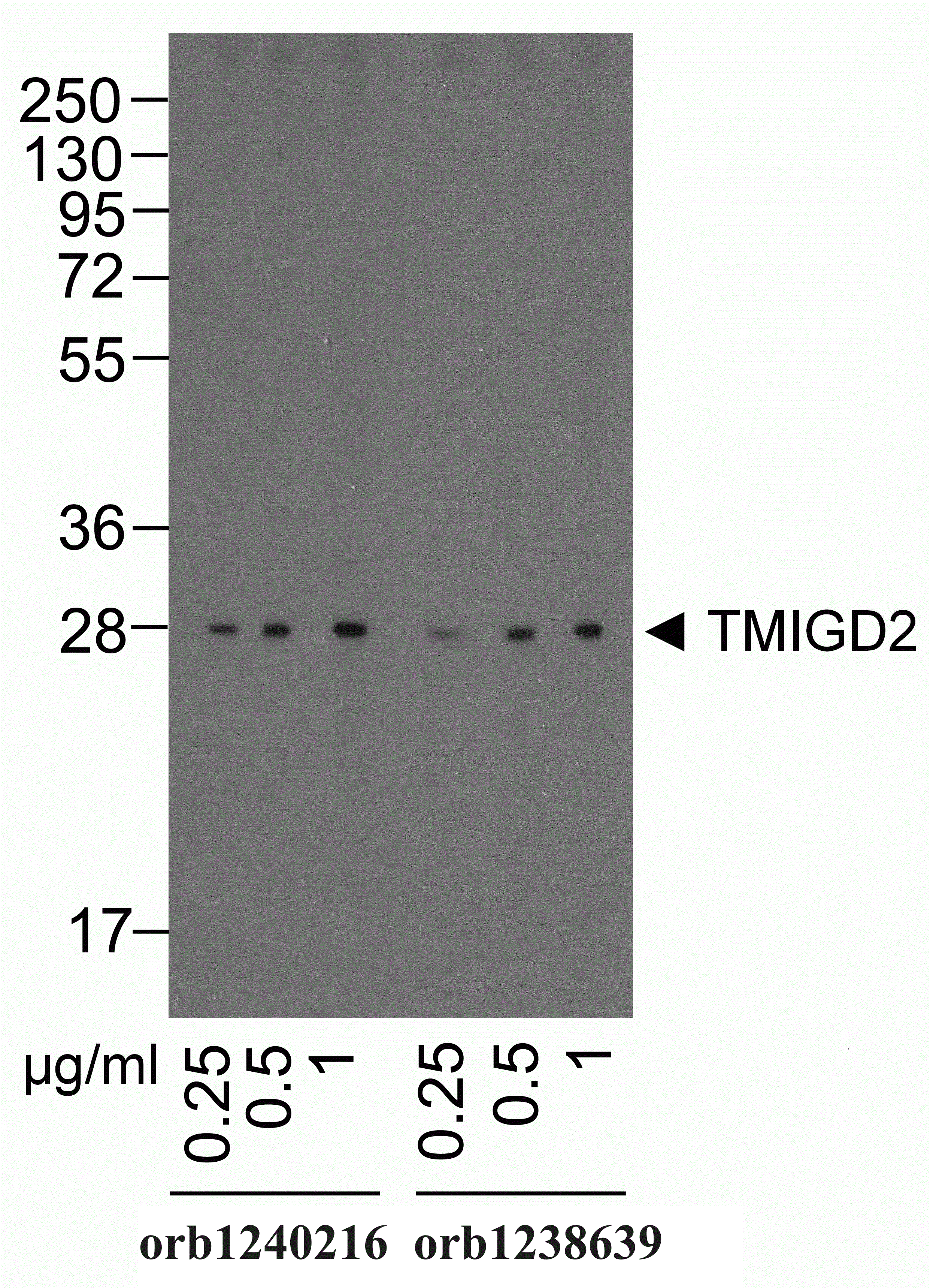 TMIGD2 Detection Set (Risk Free)