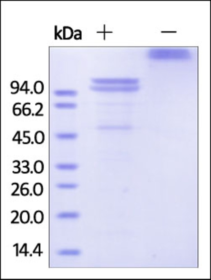 E Cadherin Recombinant Protein
