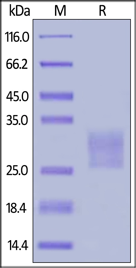 Frizzled-7 / FZD7 Recombinant Protein