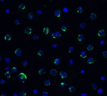 AIMF2 Antibody