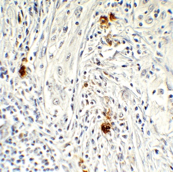 AIMF2 Antibody