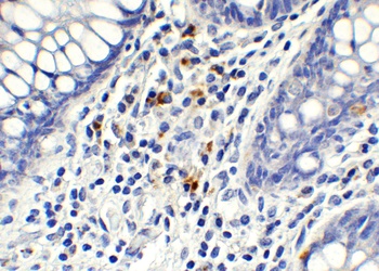 AIMF2 Antibody